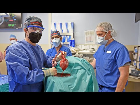 First Ever Pig to Human Heart Transplant (Official Video) - University of Maryland Medicine