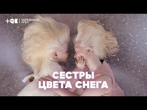 Снежная красота. Как живут сестры-альбиносы в Казахстане | ТОК