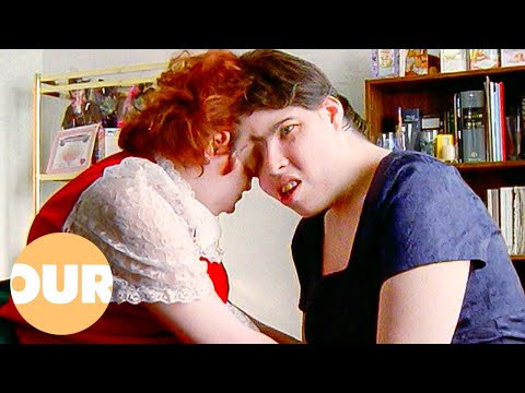 The Conjoined Twins Who Live Separate Lives | Our Life