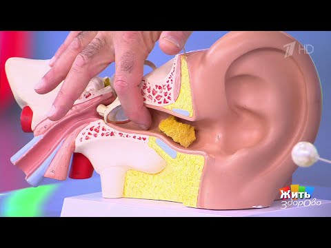Чистка ушей: помогает ли вакуум? 11.11.2025