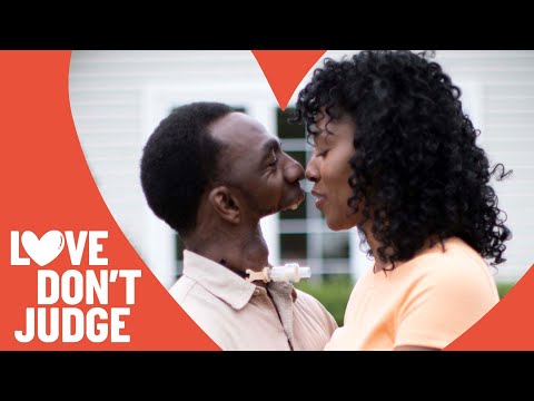 I Have No Jaw - But Still Found True Love | LOVE DON&#039;T JUDGE