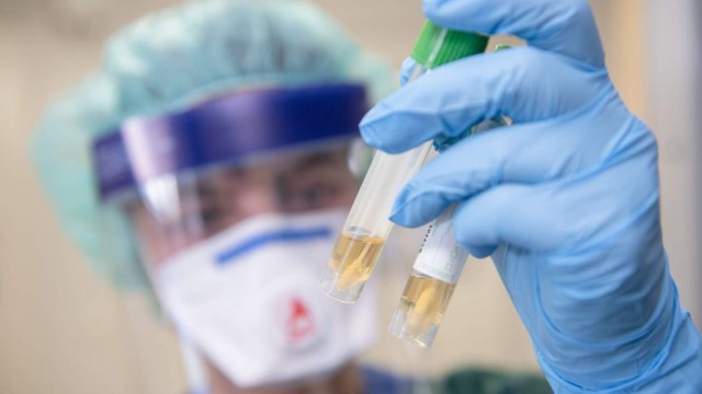 Ещё семь бессимптомных носителей коронавируса зарегистрировано в Костанайской области