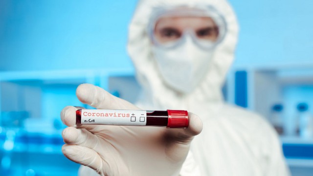 За  сутки в Казахстане выявлено 507 заболевших коронавирусной инфекцией