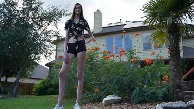 Видео: Девушка из США стала обладательницей самых длинных ног в мире