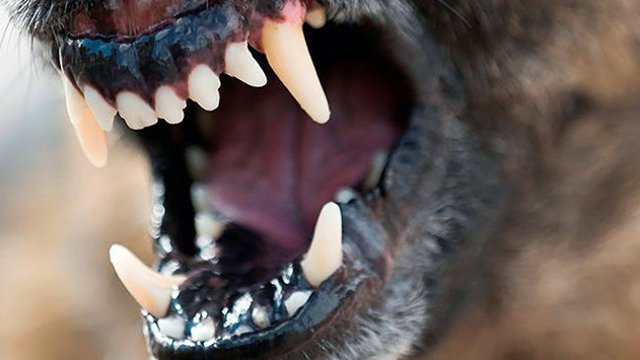 Пятилетнюю казахстанку за лицо укусила агрессивная собака