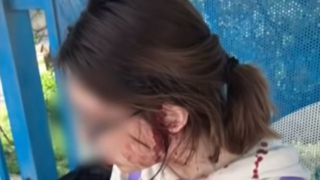 Девятиклассница жестоко избила сверстницу из-за оскорбления