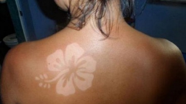 Что такое «солнечные» татуировки, и почему они смертельно опасны