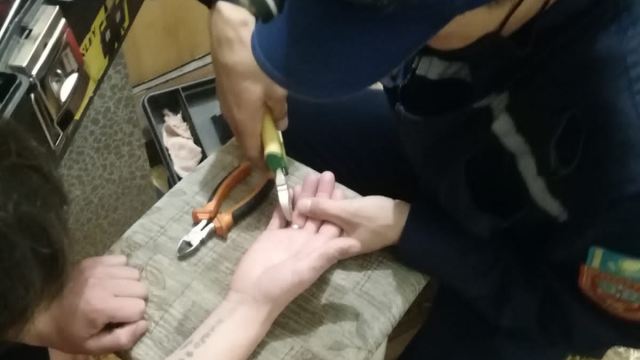 Кольцо с опухшего пальца юноши сняли спасатели в Костанае