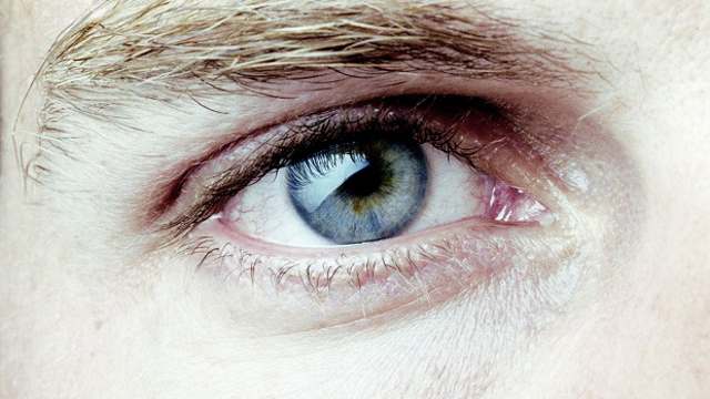 Как определить диабет и болезни печени по состоянию глаз