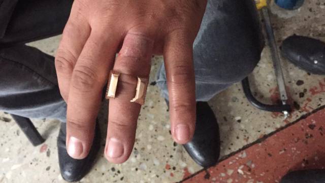 «Совсем опух»: Спасатели сняли кольцо с пальца мужчины в Костанае