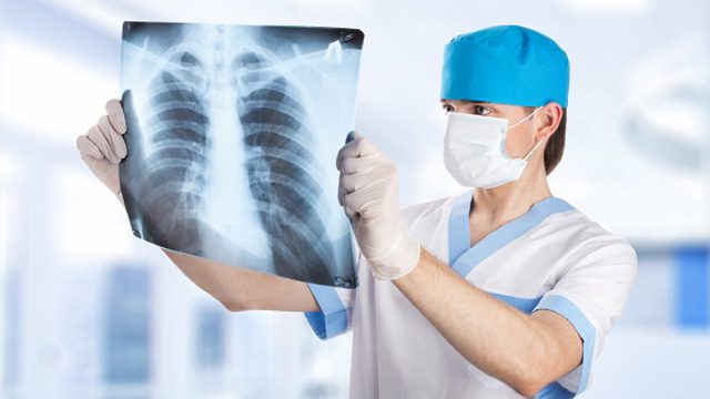 Учёные назвали признаки развития рака лёгких