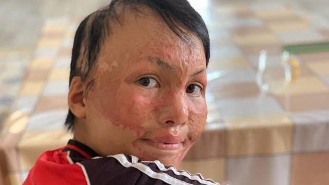 Юный художник из Казахстана накопил себе на новое лицо