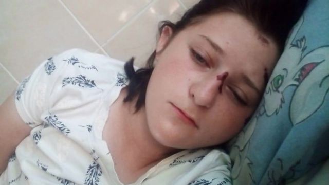 «Это дело должно дойти до суда»: 15-летнюю девочку сбили в Тобыле
