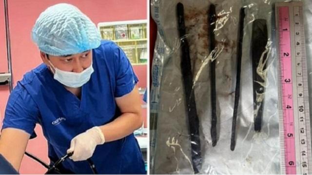 Куски 18-сантиметровой арматуры проглотил мужчина в Актау