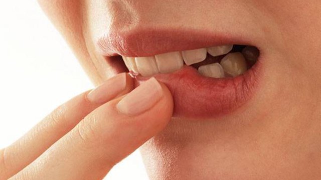 Почему немеют губы: самые распространённые причины
