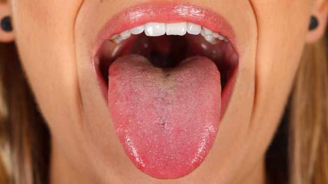 Болит нёбо во рту: какие причины и как лечить