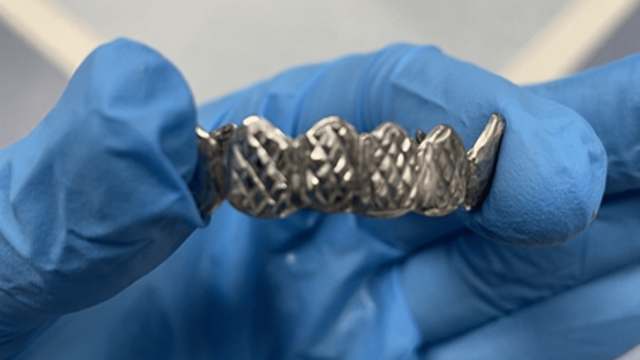 В лёгком у 22-летнего парня врачи нашли зубной протез