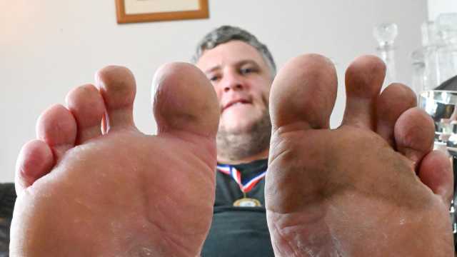 Чемпион мира удалил ногти на ногах ради соревнований