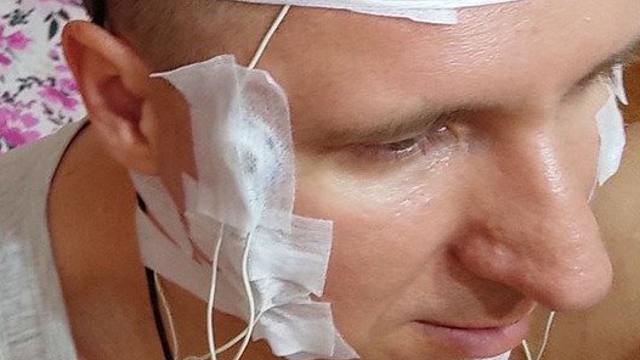 Россиянин чипировал себе мозг при помощи дрели в Алматы