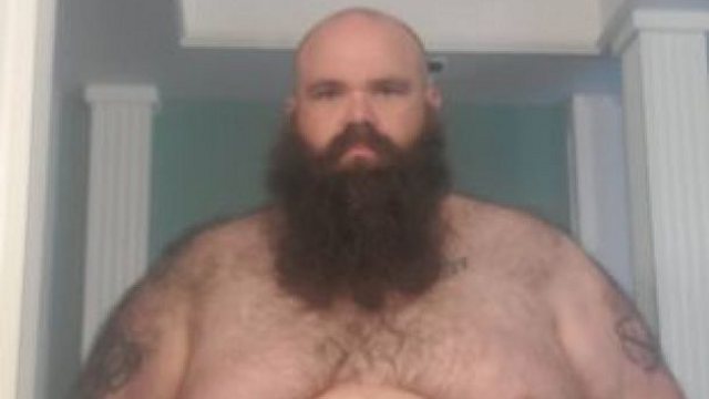 Мужчина похудел на 148 кг и пожаловался на новую проблему