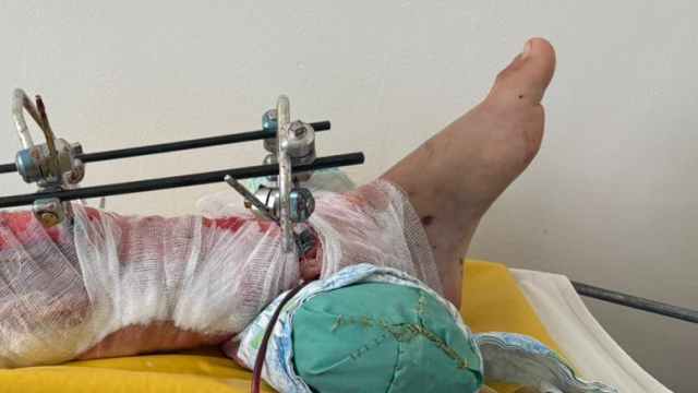 Рабочий получил серьёзную травму ноги на заводе в Костанае