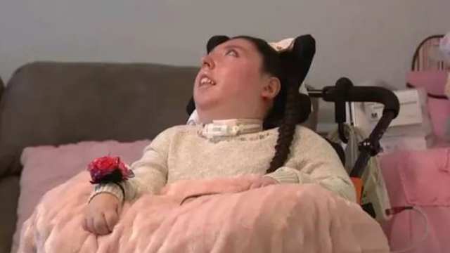 Родившаяся без мозга женщина отпраздновала 20-летие