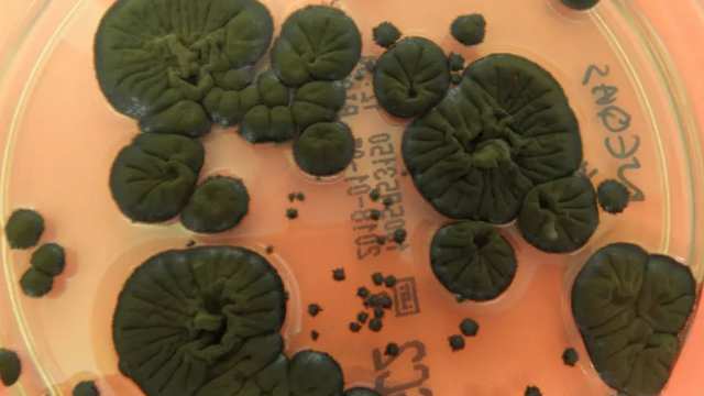 В Чернобыле нашли грибок, который питается радиацией