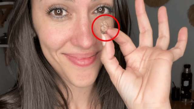 Врачи сделали в носу женщины неожиданную находку