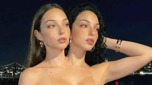 Раскрыта шокирующая правда о сиамских близняшках из Сети