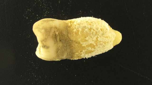 В зубе 700-летней мумии нашли смертельно опасную бактерию